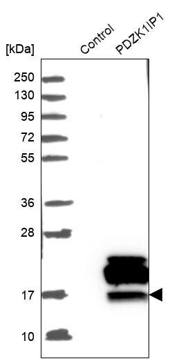 Map17 Antibody - BSA Free Western Blot: Map17 Antibody - BSA Free [NBP1-84290]