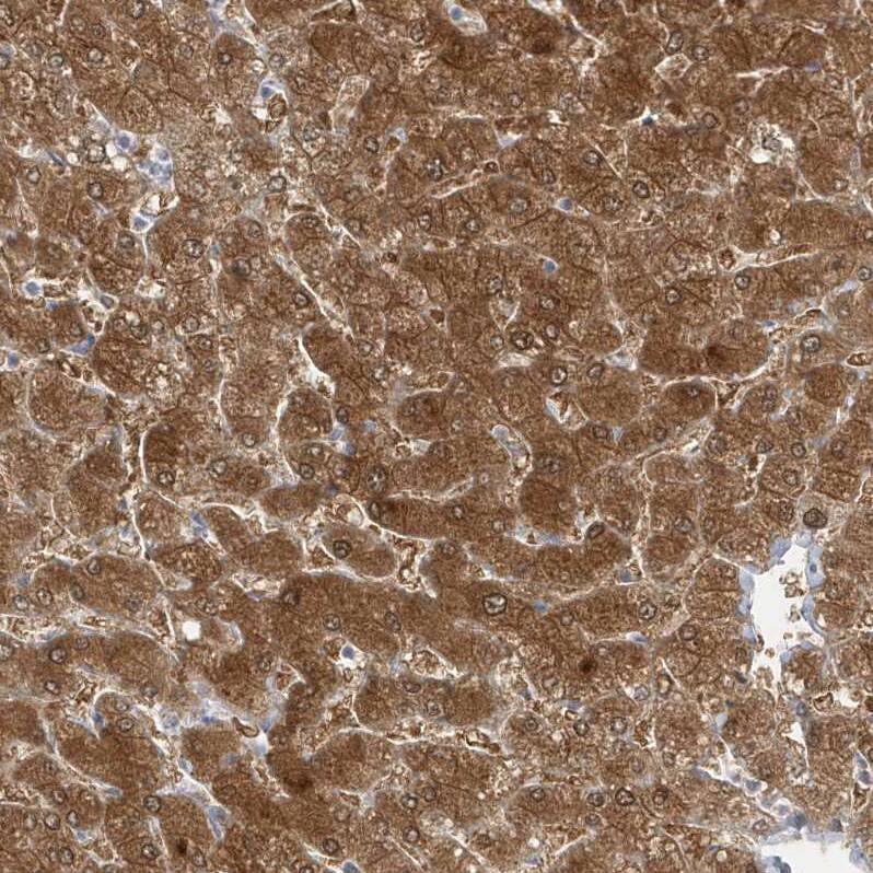 PCBD1 Antibody - BSA Free Immunohistochemistry-Paraffin: PCBD1 Antibody - BSA Free [NBP1-84297]