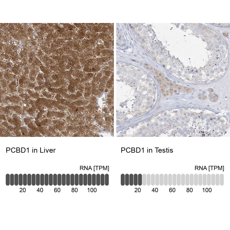 PCBD1 Antibody - BSA Free Immunohistochemistry-Paraffin: PCBD1 Antibody - BSA Free [NBP1-84297]