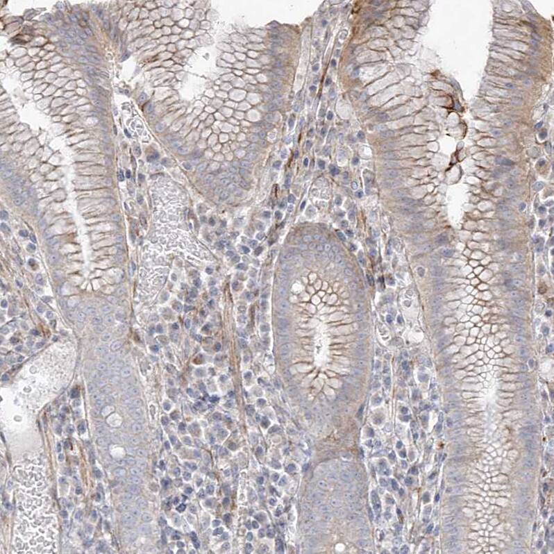 DCDC2 Antibody - BSA Free Immunohistochemistry-Paraffin: DCDC2 Antibody - BSA Free [NBP1-84298]