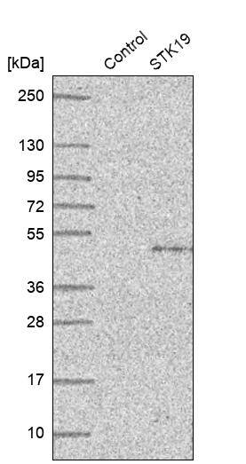 STK19 Antibody - BSA Free Western Blot: STK19 Antibody - BSA Free [NBP1-84308]
