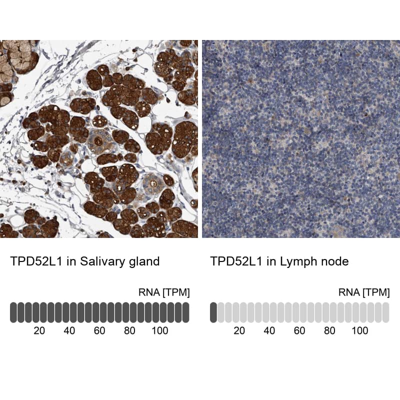 TPD52L1/D53 Antibody - BSA Free Immunohistochemistry-Paraffin: TPD52L1/D53 Antibody - BSA Free [NBP1-84313]