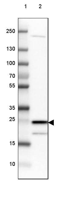 TPD52L1/D53 Antibody - BSA Free Western Blot: TPD52L1/D53 Antibody - BSA Free [NBP1-84313]