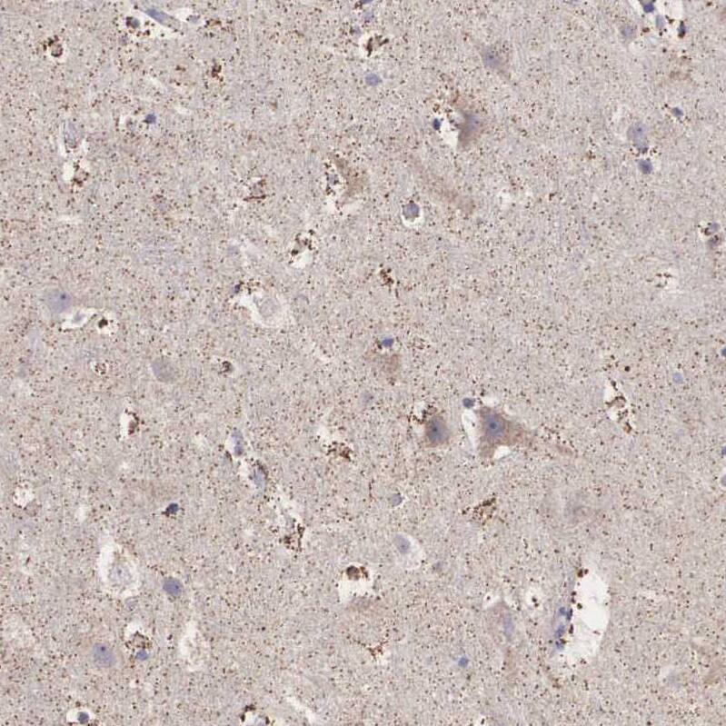 P311 Antibody - BSA Free Immunohistochemistry-Paraffin: P311 Antibody - BSA Free [NBP1-84315]