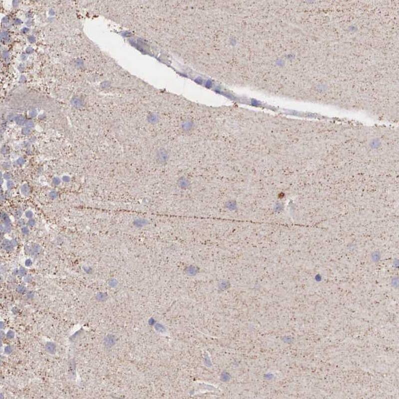 P311 Antibody - BSA Free Immunohistochemistry-Paraffin: P311 Antibody - BSA Free [NBP1-84315]