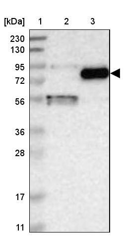 Gamma-Glutamyltransferase 7 Antibody - BSA Free Western Blot: Gamma-Glutamyltransferase 7 Antibody - BSA Free [NBP1-84319]