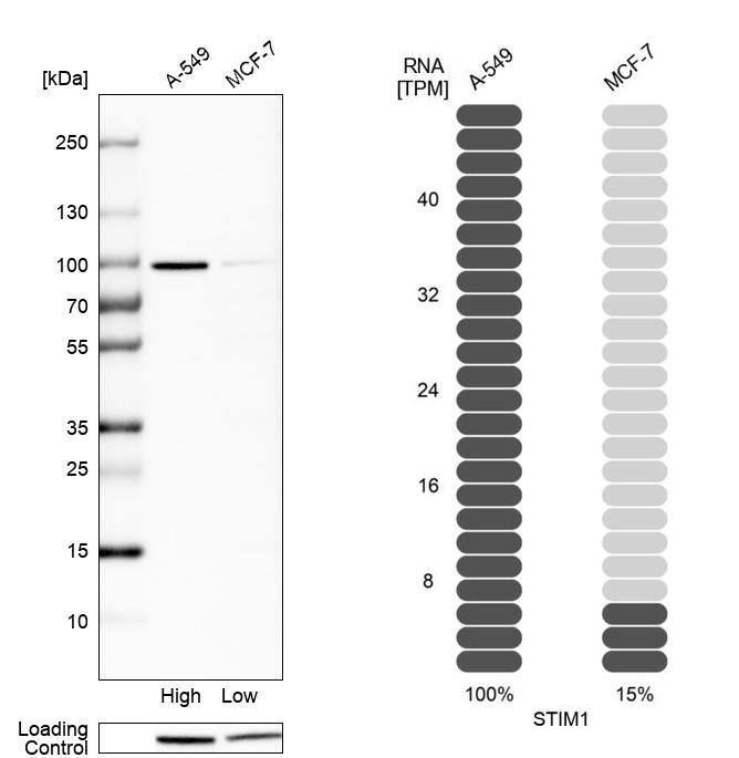 STIM1 Antibody - BSA Free Western Blot: STIM1 Antibody - BSA Free [NBP1-84322]