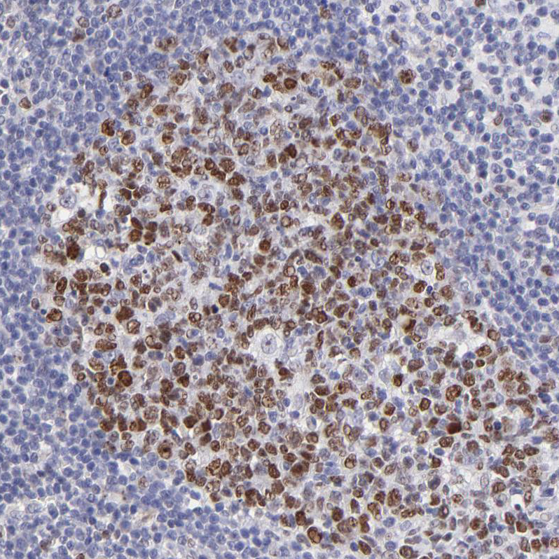 DNMT1 Antibody - BSA Free Immunohistochemistry-Paraffin: DNMT1 Antibody - BSA Free [NBP1-84328]