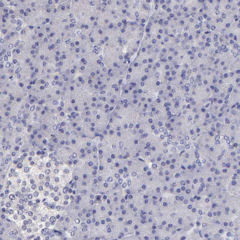 DNMT1 Antibody - BSA Free Immunohistochemistry-Paraffin: DNMT1 Antibody - BSA Free [NBP1-84328]