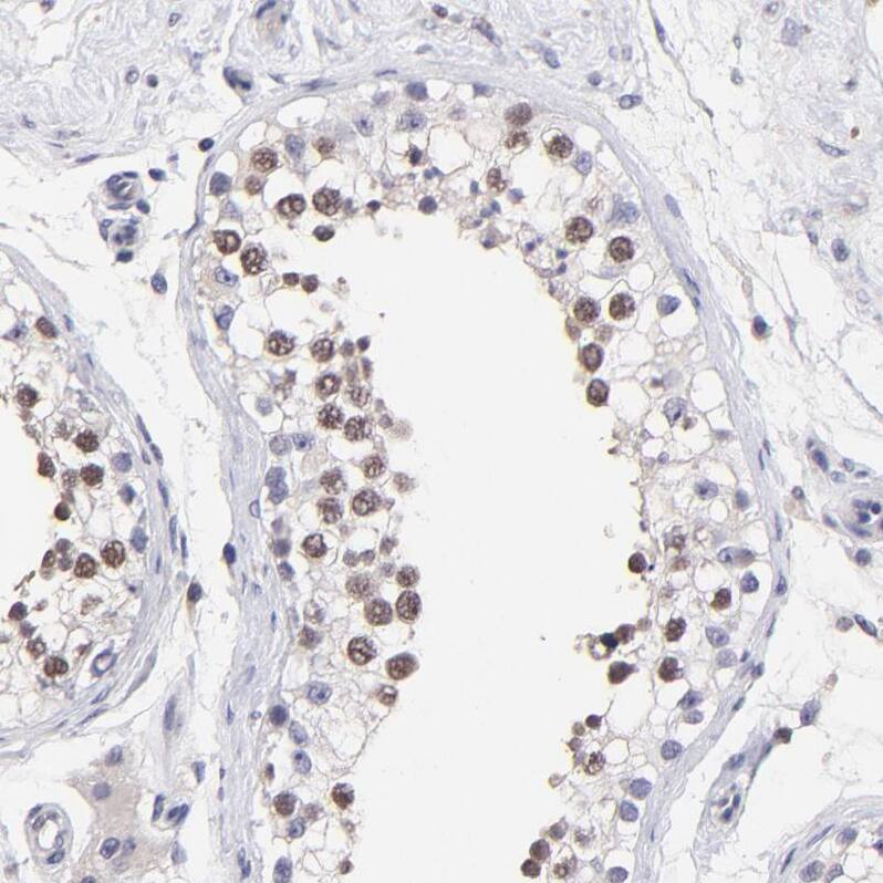 DNMT1 Antibody - BSA Free Immunohistochemistry-Paraffin: DNMT1 Antibody - BSA Free [NBP1-84328]
