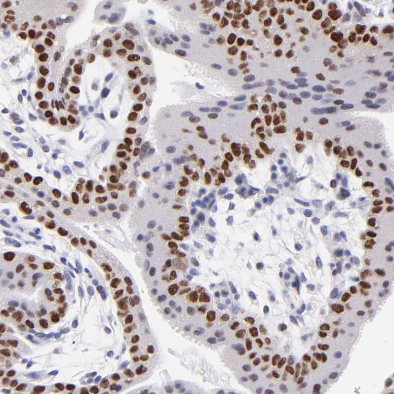 DNMT1 Antibody - BSA Free Immunohistochemistry-Paraffin: DNMT1 Antibody - BSA Free [NBP1-84328]
