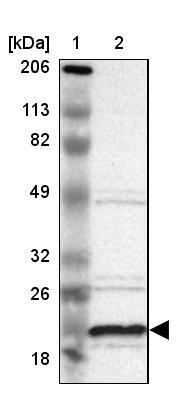 ALG13 Antibody - BSA Free Western Blot: ALG13 Antibody - BSA Free [NBP1-84330]