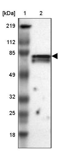 CCDC22 Antibody - BSA Free Western Blot: CCDC22 Antibody - BSA Free [NBP1-84331]