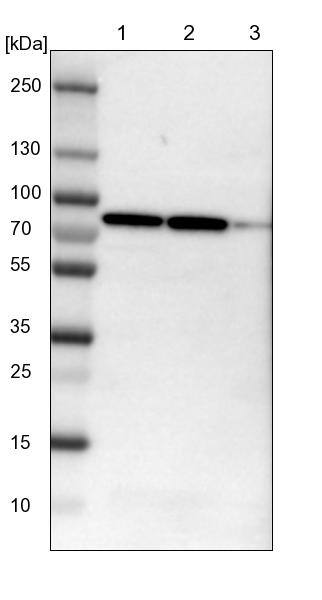 CCDC22 Antibody - BSA Free Western Blot: CCDC22 Antibody - BSA Free [NBP1-84331]
