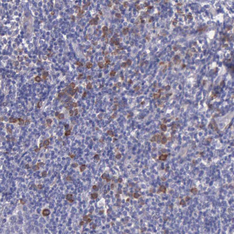 ZC3H12B Antibody - BSA Free Immunohistochemistry-Paraffin: ZC3H12B Antibody - BSA Free [NBP1-84332]