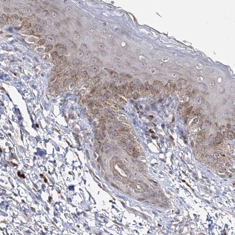 Connexin 30.1/GJB5 Antibody - BSA Free Immunohistochemistry-Paraffin: Connexin 30.1/GJB5 Antibody - BSA Free [NBP1-84333]