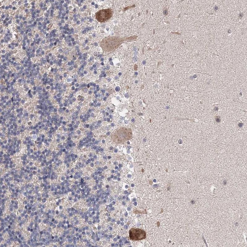 Connexin 30.1/GJB5 Antibody - BSA Free Immunohistochemistry-Paraffin: Connexin 30.1/GJB5 Antibody - BSA Free [NBP1-84333]