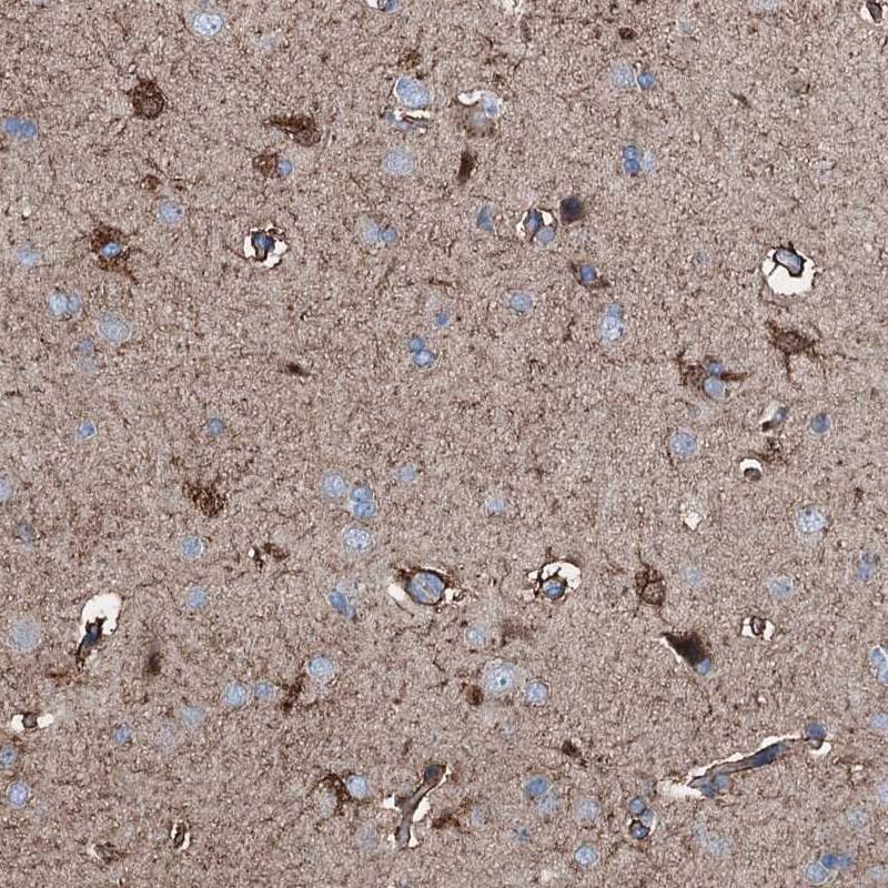 C1qTNF4/CTRP4 Antibody - BSA Free Immunohistochemistry-Paraffin: C1qTNF4/CTRP4 Antibody - BSA Free [NBP1-84335]