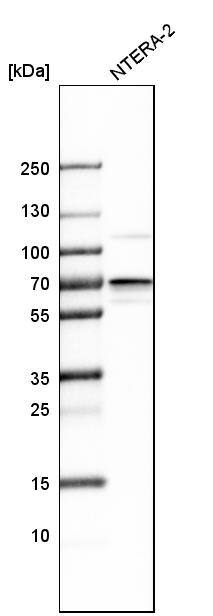 IGF2BP3 Antibody - BSA Free Western Blot: IGF2BP3 Antibody - BSA Free [NBP1-84339]