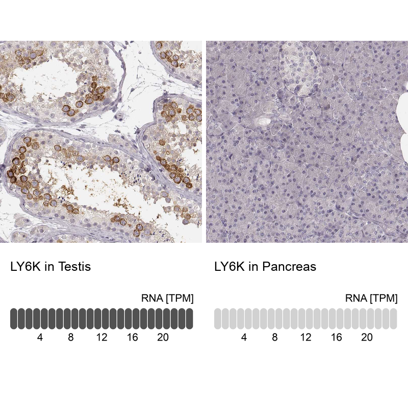 Ly6K Antibody - BSA Free Immunohistochemistry-Paraffin: Ly6K Antibody - BSA Free [NBP1-84340]