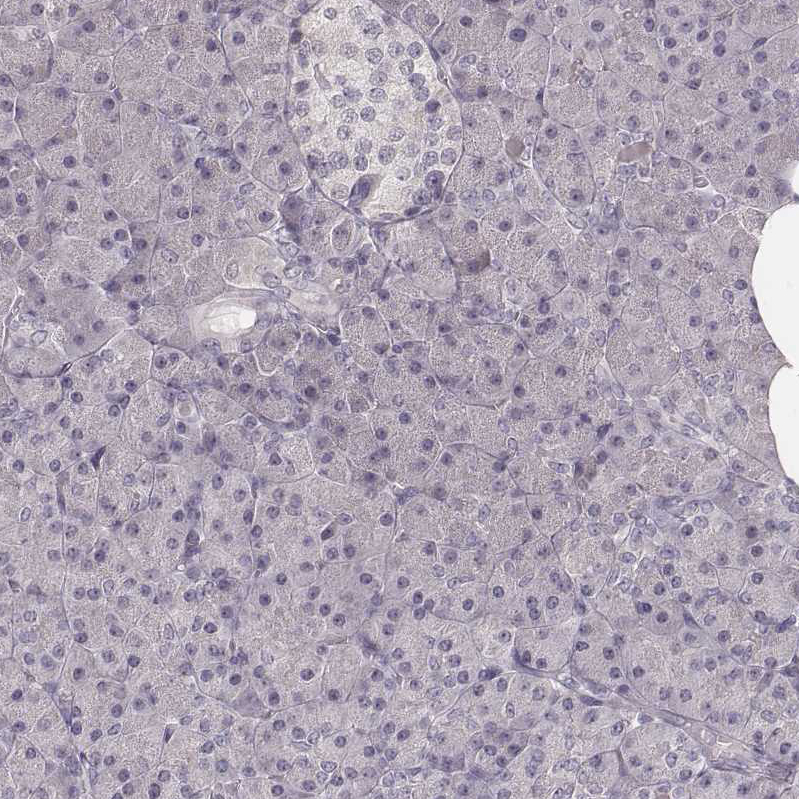 Ly6K Antibody - BSA Free Immunohistochemistry-Paraffin: Ly6K Antibody - BSA Free [NBP1-84340]