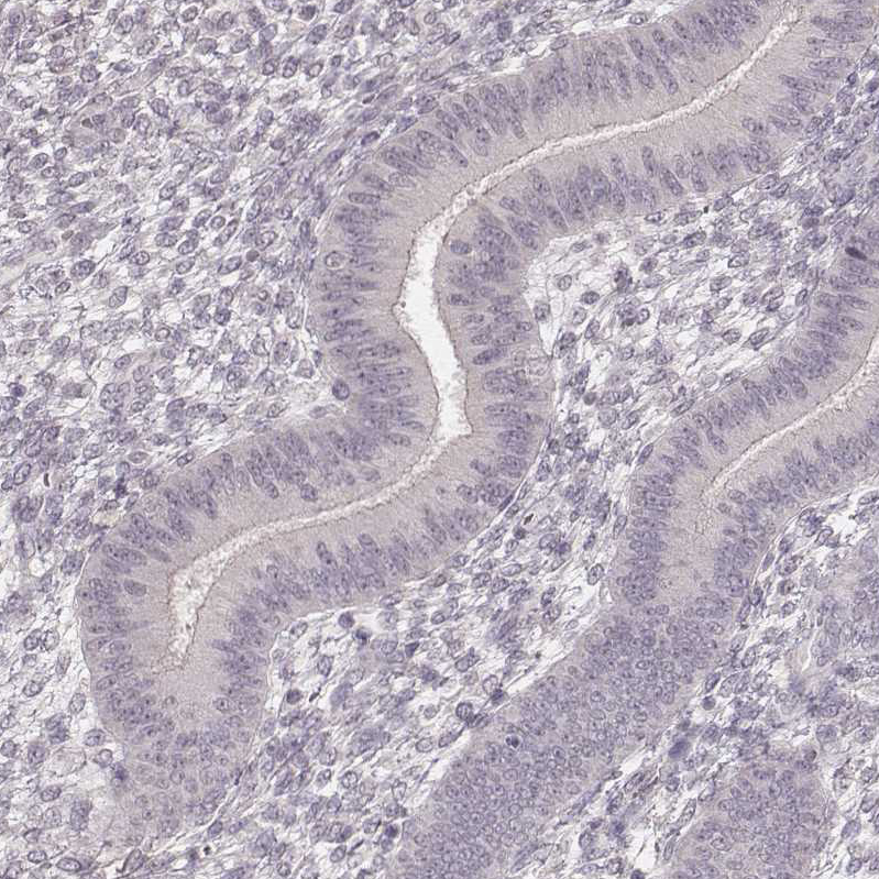 Ly6K Antibody - BSA Free Immunohistochemistry-Paraffin: Ly6K Antibody - BSA Free [NBP1-84340]