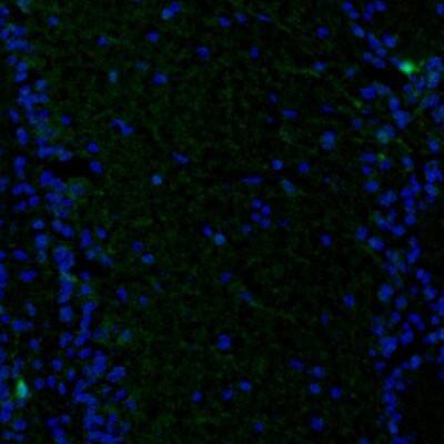 PBK Antibody - BSA Free Immunohistochemistry: PBK Antibody - BSA Free [NBP1-84342]