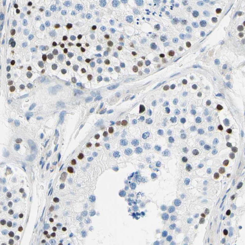 PASD1 Antibody - BSA Free Immunohistochemistry-Paraffin: PASD1 Antibody - BSA Free [NBP1-84345]