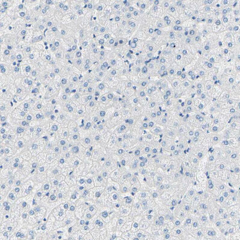 PASD1 Antibody - BSA Free Immunohistochemistry-Paraffin: PASD1 Antibody - BSA Free [NBP1-84345]