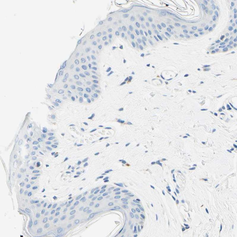 PASD1 Antibody - BSA Free Immunohistochemistry-Paraffin: PASD1 Antibody - BSA Free [NBP1-84345]