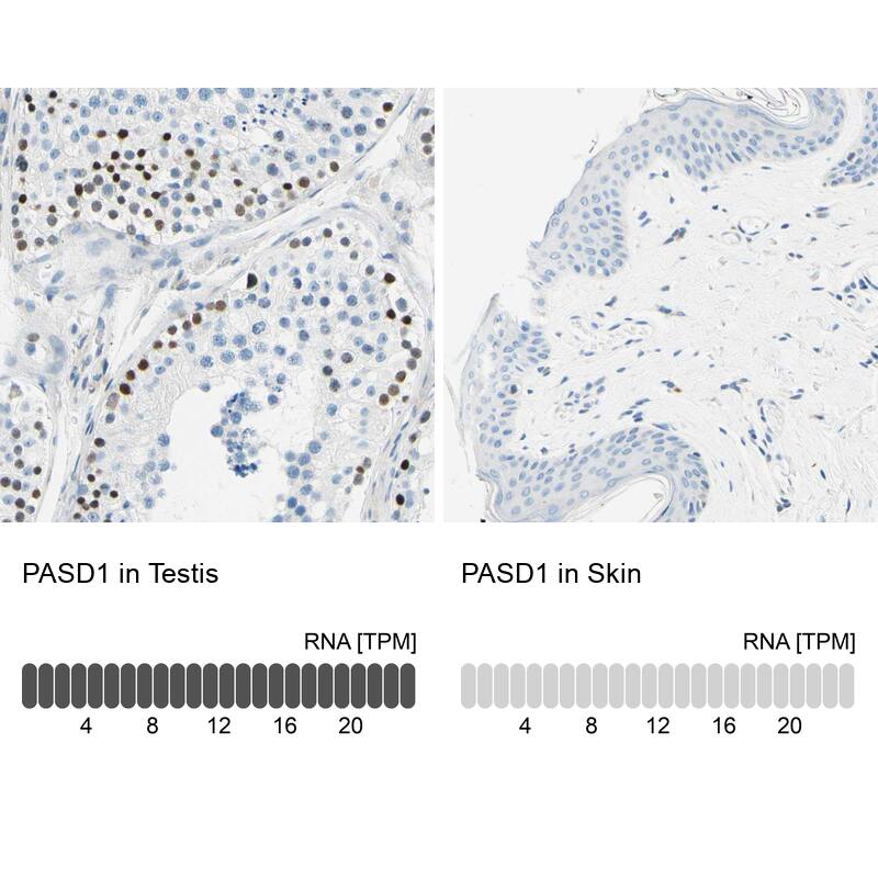 PASD1 Antibody - BSA Free Immunohistochemistry-Paraffin: PASD1 Antibody - BSA Free [NBP1-84345]