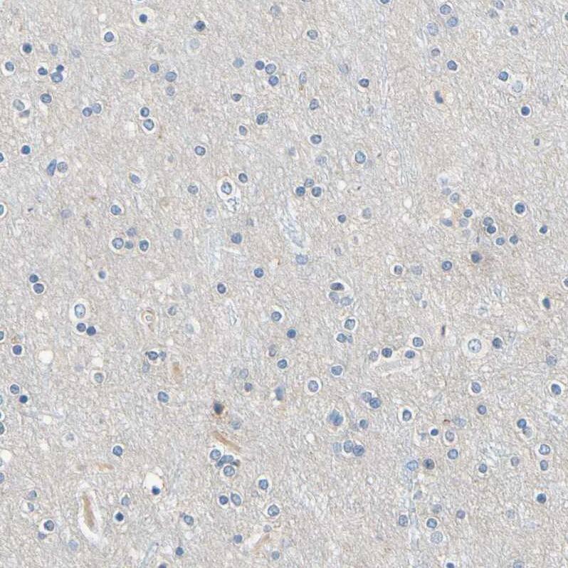 PASD1 Antibody - BSA Free Immunohistochemistry-Paraffin: PASD1 Antibody - BSA Free [NBP1-84345]