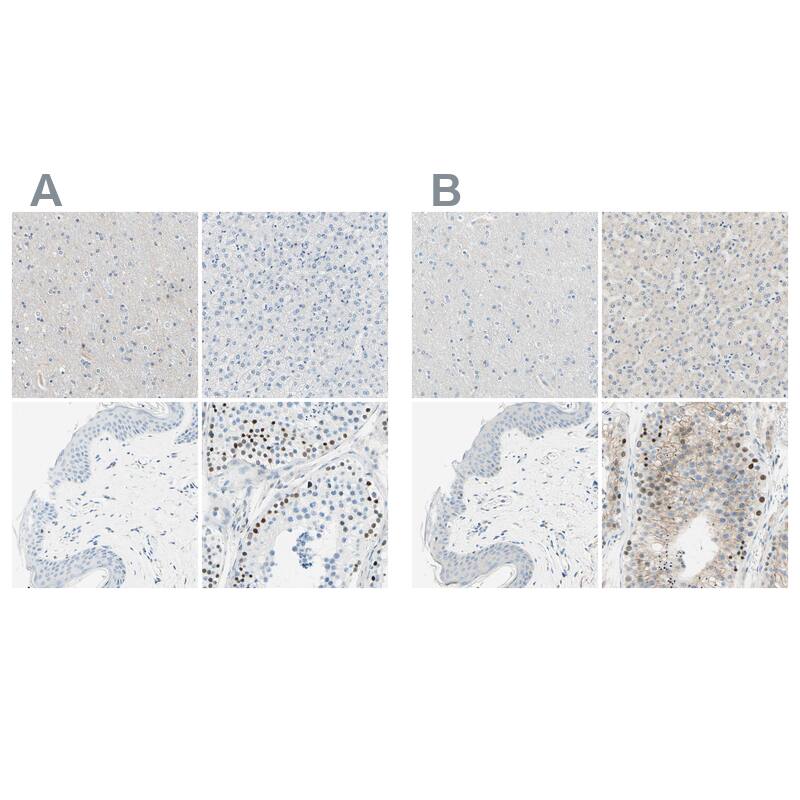 PASD1 Antibody - BSA Free Immunohistochemistry-Paraffin: PASD1 Antibody - BSA Free [NBP1-84345]