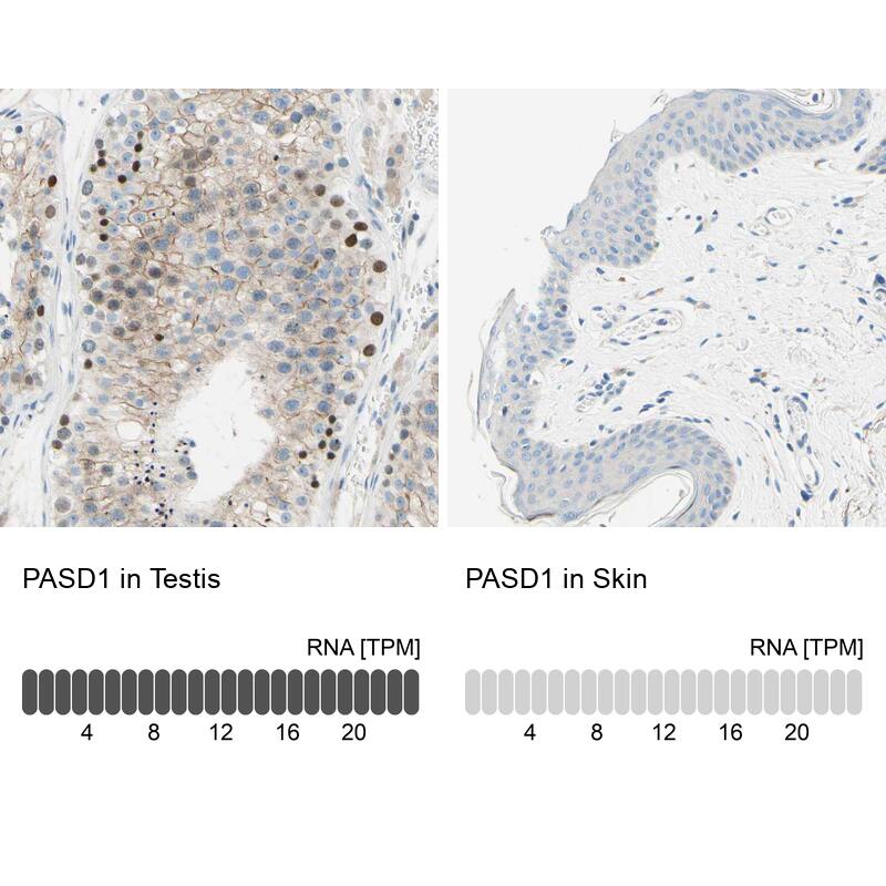 PASD1 Antibody - BSA Free Immunohistochemistry-Paraffin: PASD1 Antibody - BSA Free [NBP1-84346]