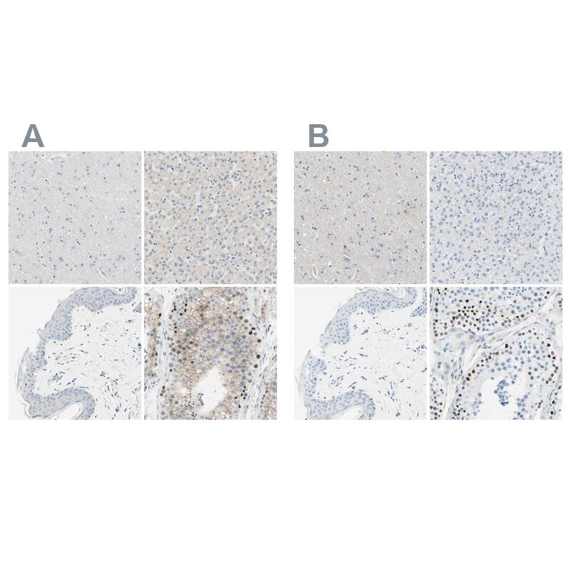 PASD1 Antibody - BSA Free Immunohistochemistry-Paraffin: PASD1 Antibody - BSA Free [NBP1-84346]