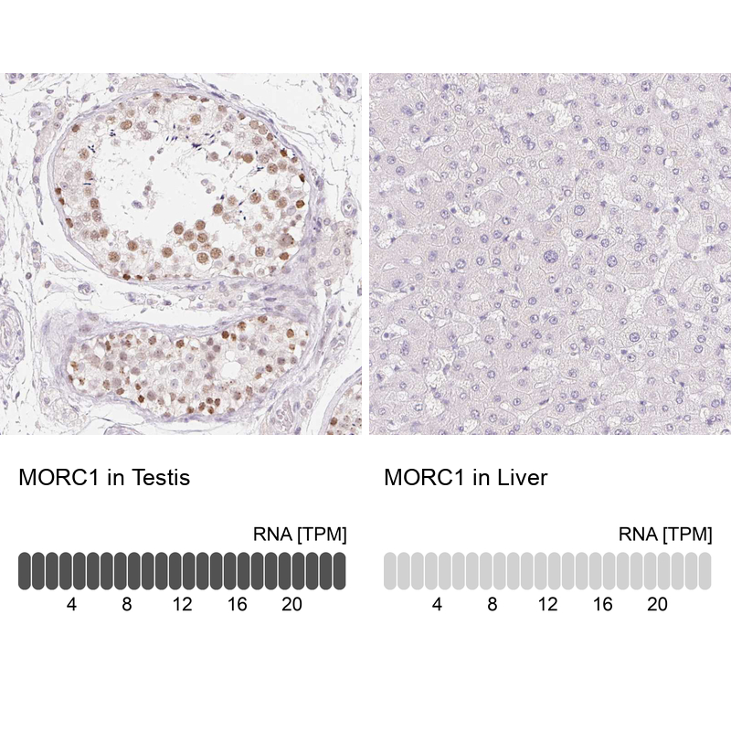 MORC1 Antibody - BSA Free Immunohistochemistry-Paraffin: MORC1 Antibody - BSA Free [NBP1-84351]