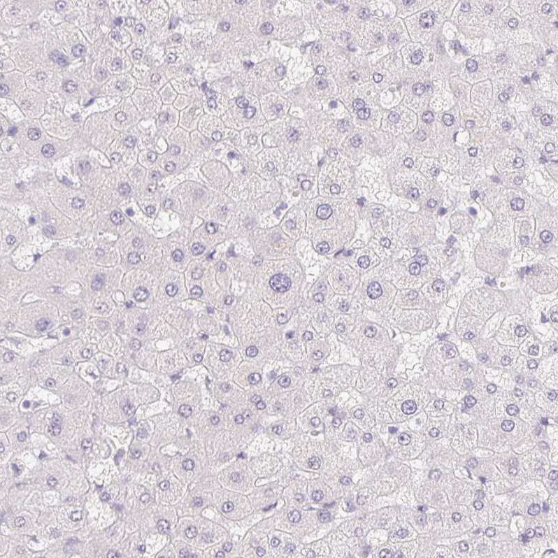 MORC1 Antibody - BSA Free Immunohistochemistry-Paraffin: MORC1 Antibody - BSA Free [NBP1-84351]