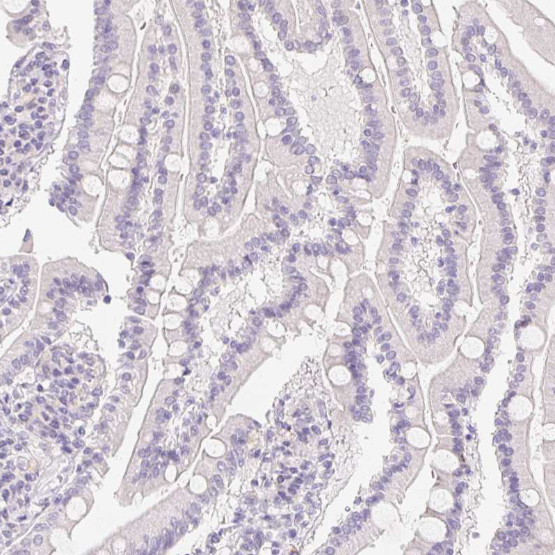 MORC1 Antibody - BSA Free Immunohistochemistry-Paraffin: MORC1 Antibody - BSA Free [NBP1-84351]