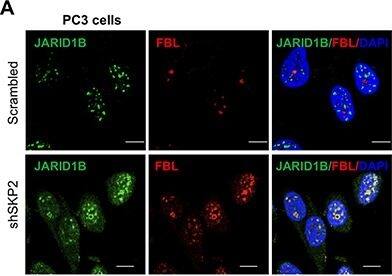 Lysine (K)-specific Demethylase 5B/KDM5B/JARID1B Antibody - BSA Free