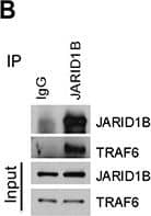 Lysine (K)-specific Demethylase 5B/KDM5B/JARID1B Antibody - BSA Free