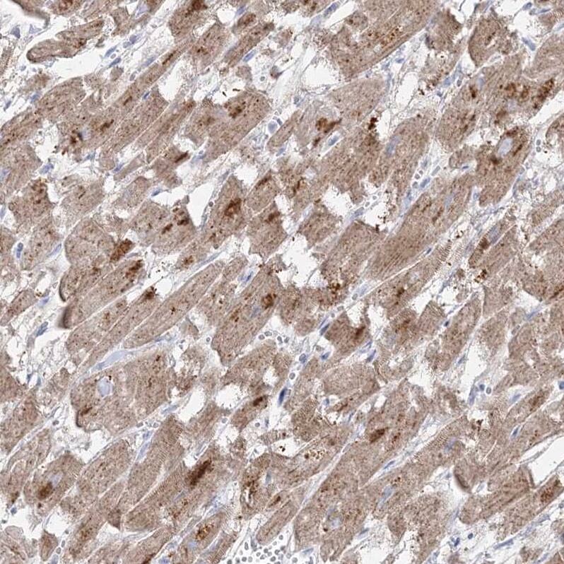 GPAT2 Antibody - BSA Free Immunohistochemistry-Paraffin: GPAT2 Antibody - BSA Free [NBP1-84360]