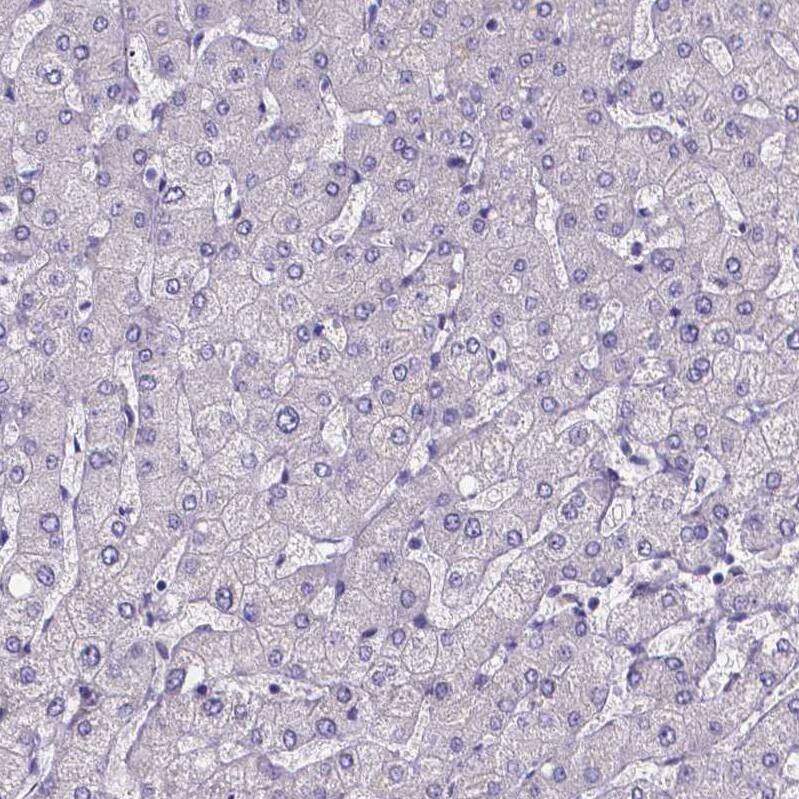 Sperm Flagellar 2 Antibody - BSA Free Immunohistochemistry-Paraffin: Sperm Flagellar 2 Antibody [NBP1-84361]