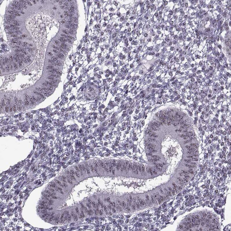 MAGEA4 Antibody - BSA Free Immunohistochemistry-Paraffin: MAGEA4 Antibody - BSA Free [NBP1-84365]