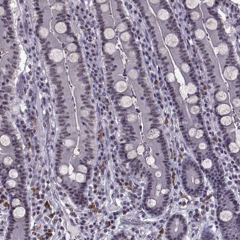 MAGEA4 Antibody - BSA Free Immunohistochemistry-Paraffin: MAGEA4 Antibody - BSA Free [NBP1-84365]