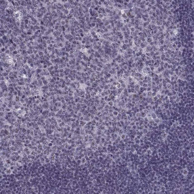 MAGEA4 Antibody - BSA Free Immunohistochemistry-Paraffin: MAGEA4 Antibody - BSA Free [NBP1-84365]