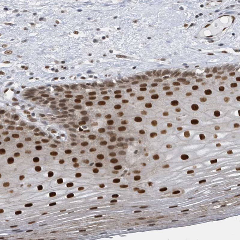 PCYT1A Antibody - BSA Free Immunohistochemistry-Paraffin: PCYT1A Antibody [NBP1-84366]