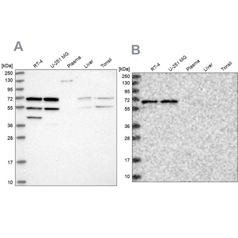SIAE Antibody - BSA Free Western Blot: SIAE Antibody - BSA Free [NBP1-84371]