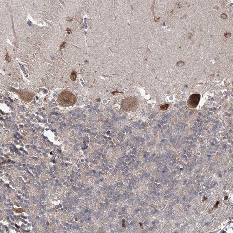 SIAE Antibody - BSA Free Immunohistochemistry-Paraffin: SIAE Antibody - BSA Free [NBP1-84371]