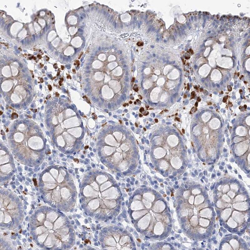 SIAE Antibody - BSA Free Immunohistochemistry-Paraffin: SIAE Antibody - BSA Free [NBP1-84371]