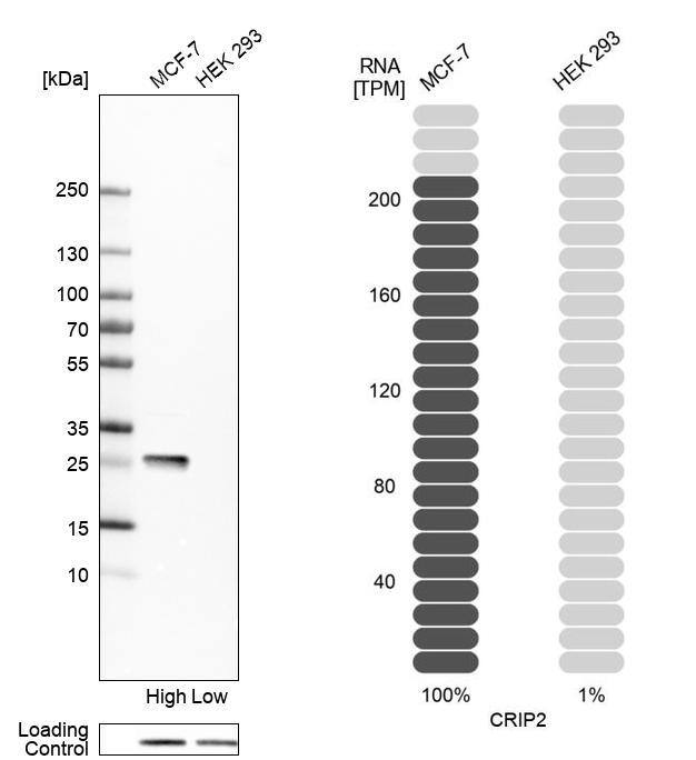CRIP2 Antibody - BSA Free Western Blot: CRIP2 Antibody - BSA Free [NBP1-84379]